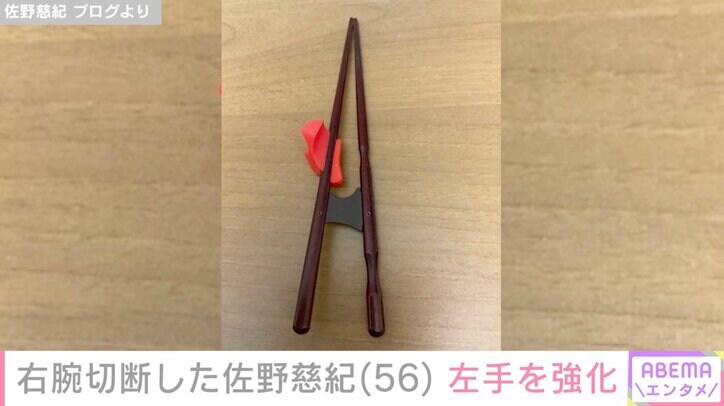 【写真・画像】右腕切断した元プロ野球投手・佐野慈紀氏「なかなか慣れなくて…」左手を強化するアイテムを紹介 1枚目