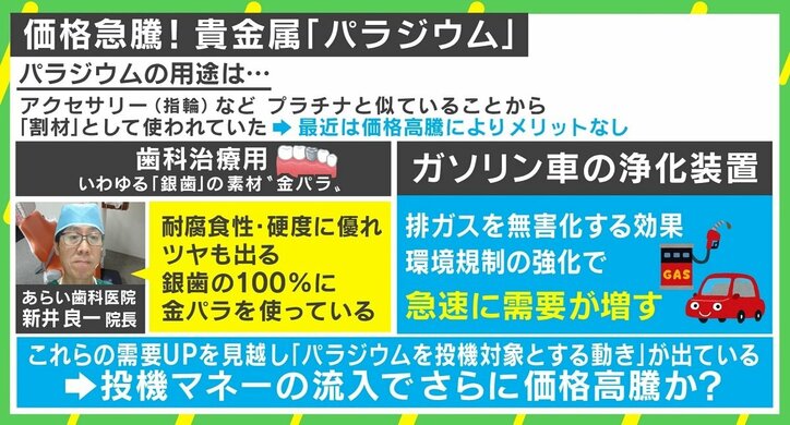 排ガス規制が「銀歯」に影響、原材料のパラジウムが高騰 「100万円前後の持ち出しも…」