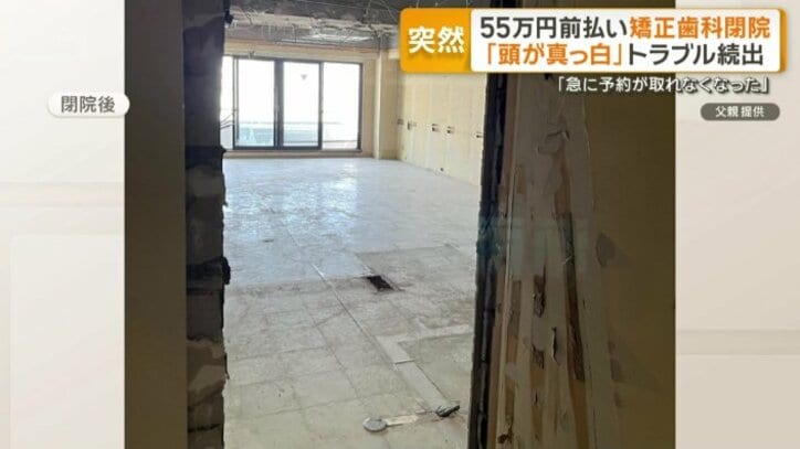 「跡形も面影もない…」上野の矯正歯科