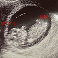 だいたひかる『私の性別予想は…』