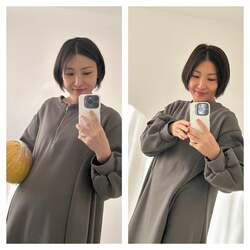  はあちゅう氏、顔に変化が現れ比較ショットを公開「薬変えたからか」 