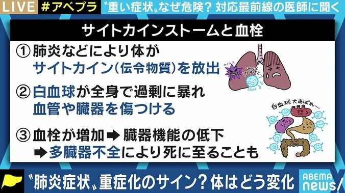 異なる重症者の定義 重症化因子が特定できていない背景も？ 最前線医師に聞く医療の現状と課題 7枚目