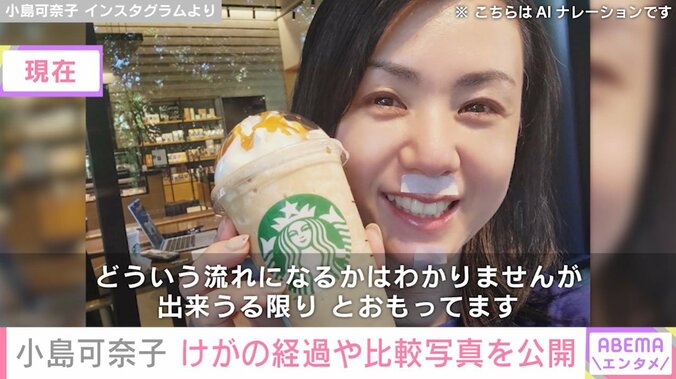 現在の小島可奈子