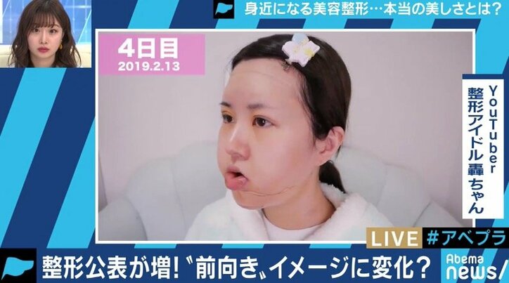 整形手術のイメージが変化、希望者が増加中？専門家「ゴールは美しい自分ではなく、明るい自分」