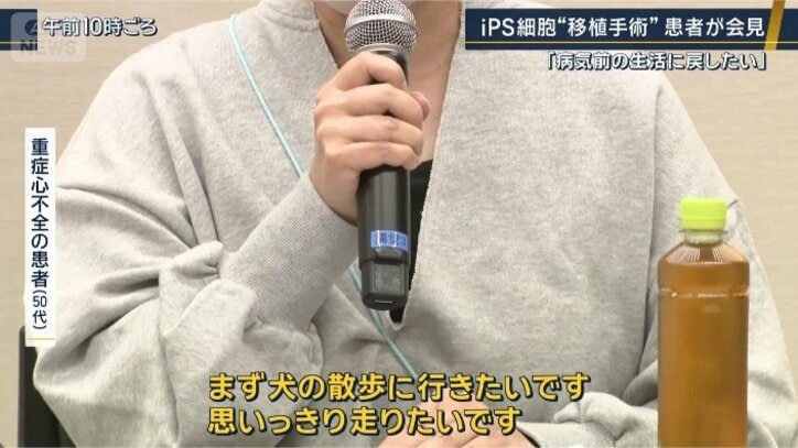 重症心不全の患者(50代)