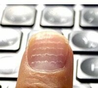 笠井信輔『爪に筋が…』