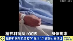「骨退院を希望する家族も…」精神疾患に“身体拘束”は必要か？ 専門家と考える正当性と人権