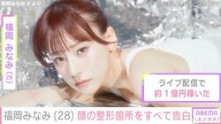 福岡みなみ「私のお顔は全パーツが整形済みです」整形詳細明かしビフォーアフターを公開