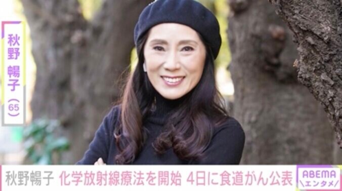 秋野暢子、食道がんの化学放射線療法を開始「宇宙船のコックピットにいるような感じ」 1枚目