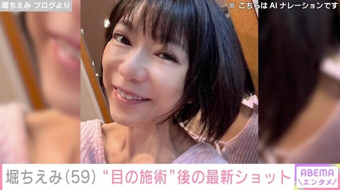 【写真・画像】堀ちえみ（59）、目の“施術”後の姿に反響「SEXYな瞳」「いい感じです」　1枚目