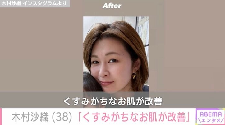 【写真・画像】“水着姿が話題”元バレーボール日本代表・木村沙織（38）「くすみがちなお肌が改善」ビフォーアフター公開　2枚目