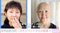 「スキンヘッドから大変身!」古村比呂、抗がん剤治療で脱毛後の記録写真公開