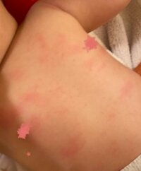 光上せあら『娘、脳外科にかかることになりました』