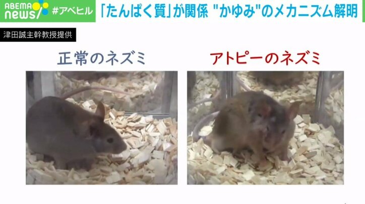 何度かいても治らない…“かゆみの悪循環”から抜け出すには? 教授が仕組みを解説