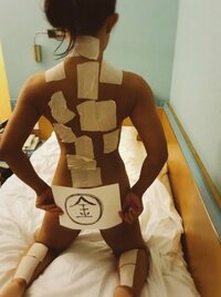 キンタロー。社交ダンス・ドイツ大会の思い出振り返り、全裸湿布写真も公開