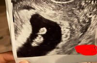 光上せあら『緊張で病院へ！！HISAKOさんと動画撮れた喜び！』