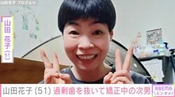 山田花子（51）、過剰歯を抜いてマウスピースで矯正している次男の様子を公開