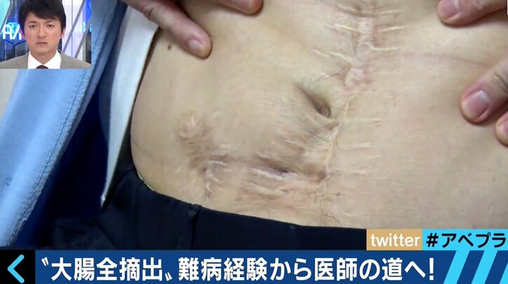 空前の「うんちブーム」 うんちの大切さを訴える人々に密着!