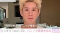 ワンオク・Taka、パニック障害を告白「マジで心配はしてほしくなくて」「そっとしといてください」