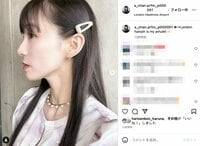 Perfumeあ～ちゃん、ほっぺの腫れがひいた美しいフェイスラインを披露 ファンからは「めっちゃ美しいんですけど～」「治ってよかった」と安堵の声