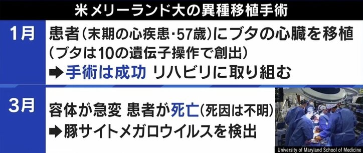 ひろゆき専用臓器も可能に? 10年後には実現か ブタ→人間の異種移植