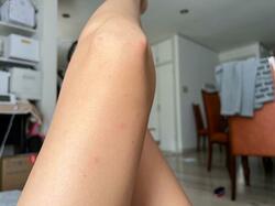  美優、退院後に治りかけていた症状が悪化したことを告白「飲み薬を飲んでいるのですが」 