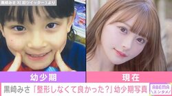 「2000万かけて整形しなくてもよかった説」 黒崎みさが公開した幼少期と現在のビフォーアフターに驚きの声