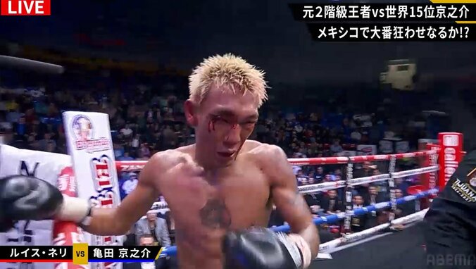 京之介の両目尻からは出血が