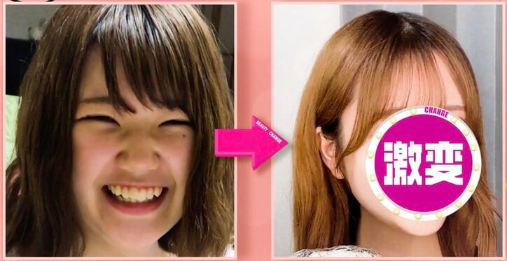 【写真・画像】2日に1回の深夜ラーメンで激太り！“69キロ→44キロ”美女のビフォーアフターに衝撃「顎にがんもどきが生えてるって言われていた」　1枚目