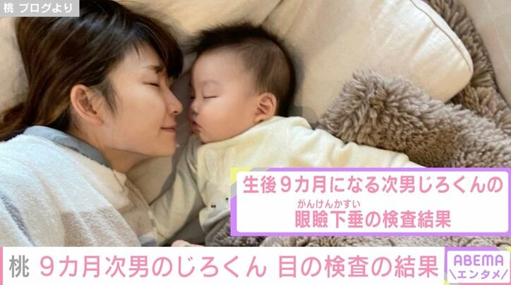 桃、9カ月次男の眼瞼下垂の検査結果を報告「そのうち軽く手術したら大丈夫みたい」