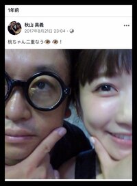 桃『整形して1年。』