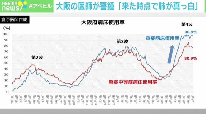 病床ひっ迫で入院厳しく…「来た時点で肺が真っ白」 大阪の医師が警鐘「第3波以前とは全く別の病気という印象」 2枚目