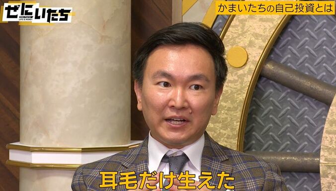 かまいたち山内、育毛に月14万円投資「生えてきたのは耳毛だけ」 3枚目