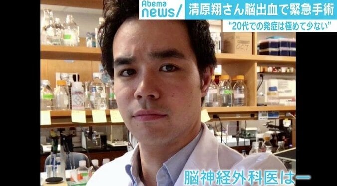 俳優・清原翔「脳出血」で緊急手術…発症極めて少ない20代でなぜ？ 症状を察知する“FAST” 3枚目