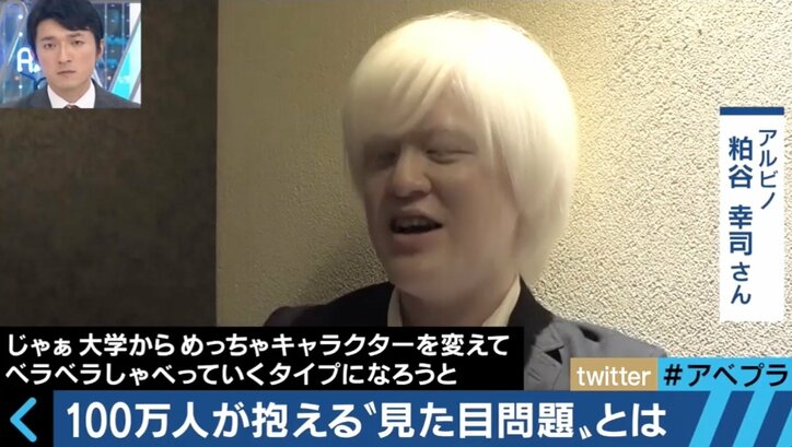 実は100万人が抱える“見た目問題” 当事者たちの生きづらさとは