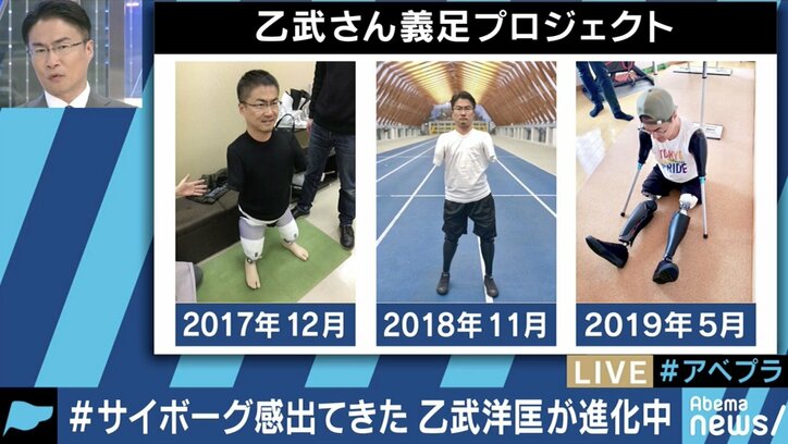 ​​​​​​​乙武氏の義手・義足姿に大反響「10年後、20年後は皆さんよりも僕の身体の方が便利になっているかも」