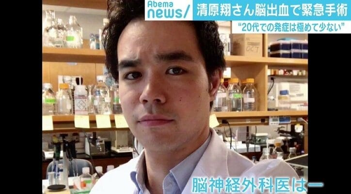 俳優・清原翔「脳出血」で緊急手術…発症極めて少ない20代でなぜ? 症状を察知する“FAST”