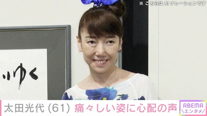 【写真・画像】太田光の妻・太田光代、左頬がガーゼで覆われた痛々しい姿を公開「頬が大変な事に…」「綺麗に治るよう願っています」などの声　1枚目