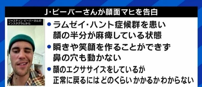 「自分の顔が自分の顔じゃなくなってしまう感じが残った」ジャスティン・ビーバーも罹患した“ラムゼイ・ハント症候群”、発症のピークは20代と50代に 8枚目