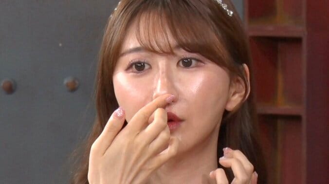 【写真・画像】1500万円でアイドル顔を手にいれた美女、骨切りダウンタイム中の姿に驚きの声「いつ人間に戻れるのか不安でした」　1枚目