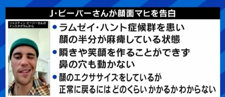「自分の顔が自分の顔じゃなくなってしまう感じが残った」ジャスティン・ビーバーも罹患した“ラムゼイ・ハント症候群”、発症のピークは20代と50代に