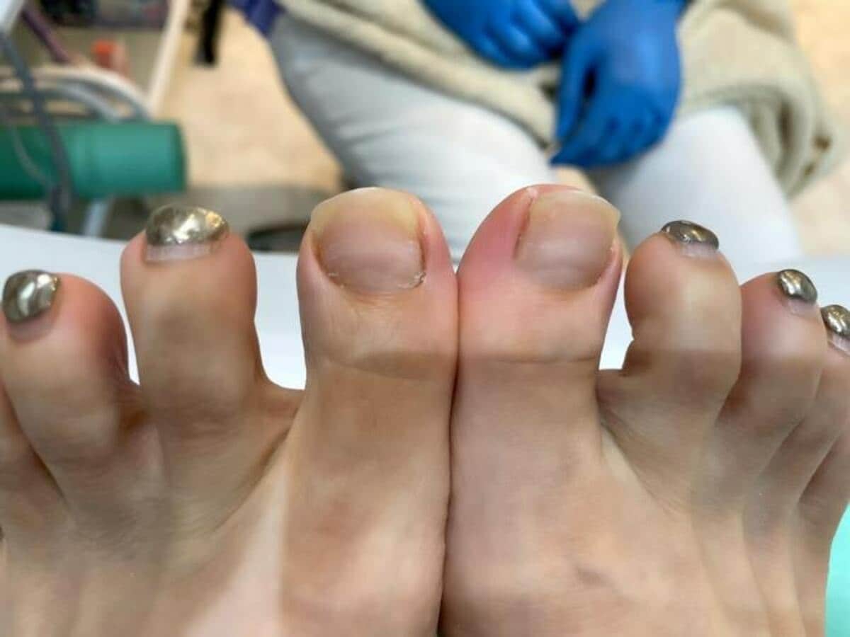 芸能人 足 の 爪