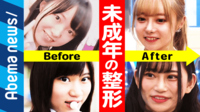 【映像】整形はアップデート？ 女子高生時代に数百万円かけた女子が生出演