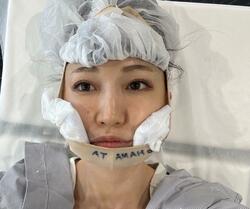  あいのり・桃、急遽受けた大掛かりな美容施術「すごく老けて見えて気になってた」 