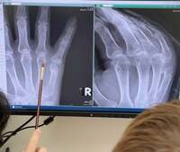 小柳ルミ子『先生の第一声』