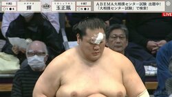 額から大出血の負傷力士 ガーゼで視界が狭まるも、取り直しの一番で気合いが呼んだ勝利「よくやった」「輝いた！」ファン興奮