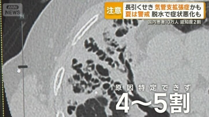 4～5割は原因特定できず