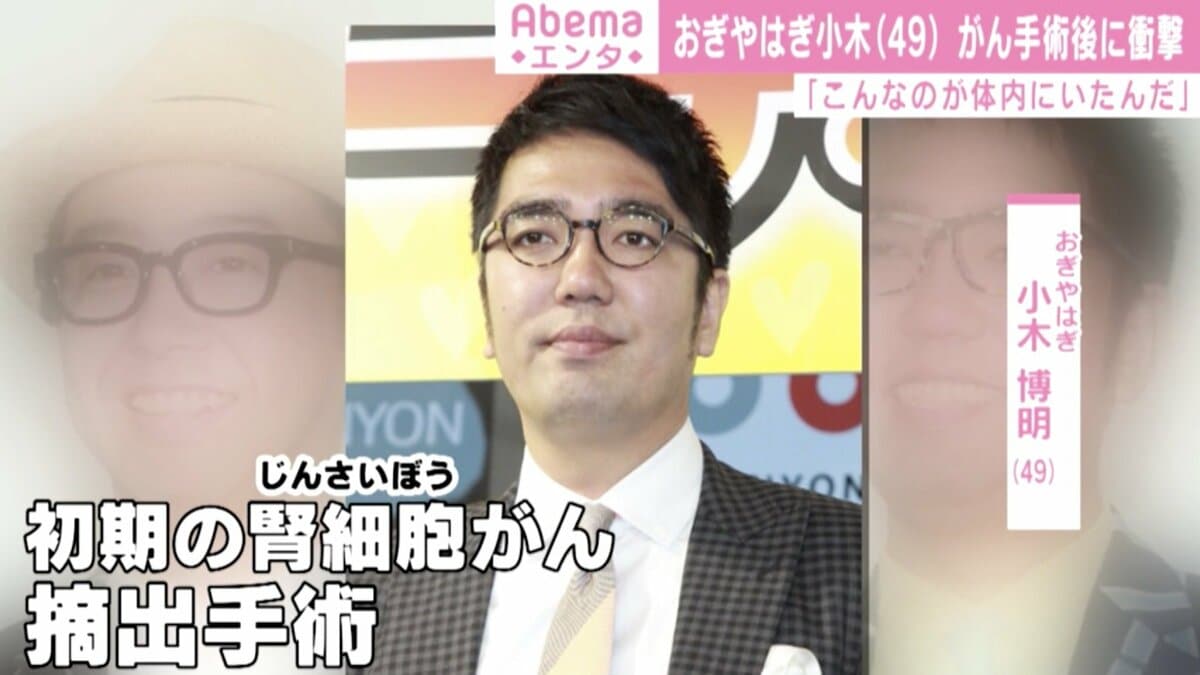 おぎやはぎ小木 がん摘出手術を終え仕事復帰 こんなのが体内にいたんだと 芸能 Abema Times