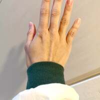 石田あゆみ『【関節リウマチ】右中指の第二関節』