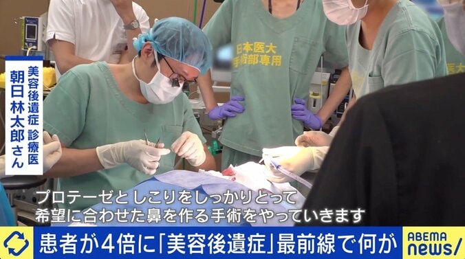 「口元の感覚がなくなって…」美容整形後のリスク “後遺症”患者増加に医師が警鐘 2枚目